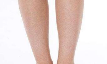 北京聯(lián)合麗格王巖醫(yī)生雙眼皮療效大揭秘，令人驚艷的成功案例浮出水面