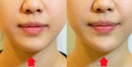 尋找北京地區(qū)值得推薦的優(yōu)質(zhì)植發(fā)醫(yī)院