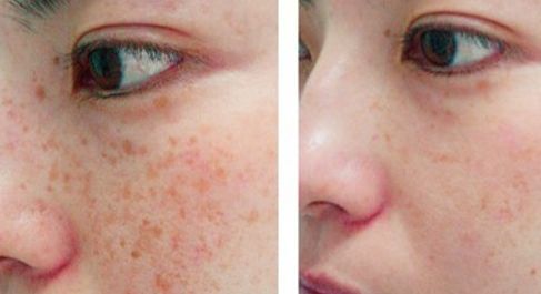 贛州亞韓醫(yī)療美容門診部整形手術適合嗎？吳禮誠醫(yī)生技術評價如何