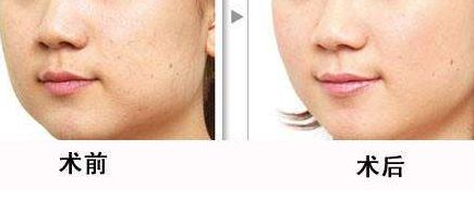 北京清華長庚醫(yī)院為何不列入三甲？整形技術如何？名醫(yī)推薦給你