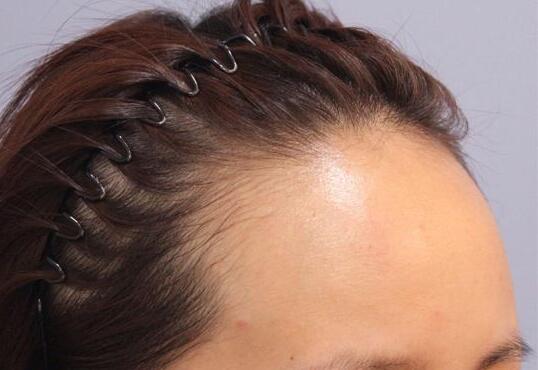 哈爾濱羽禪醫(yī)美，哪些熱門項目受歡迎？