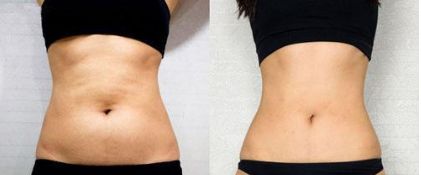 北京下頜角顴骨矯正，這幾家醫(yī)院排名前五不可信！