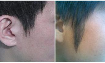 西安著名拉皮手術(shù)醫(yī)生推薦！專家團隊不俗技藝，魯禮新、楊萬忠亮相