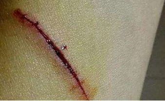 北京祛斑兩全皆美，這些醫(yī)院實(shí)力收割好評(píng)！