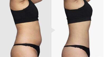 沈陽(yáng)國(guó)防醫(yī)院簡(jiǎn)介：為什么選擇沈陽(yáng)國(guó)防醫(yī)院進(jìn)行醫(yī)美整形？