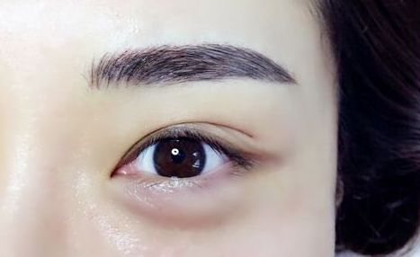 重慶杰出眼科專家范文亮醫(yī)生：醫(yī)術高超，多個成功案例揭秘