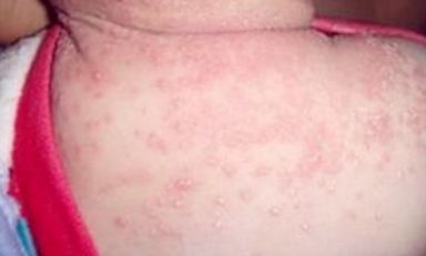 蘇州維多利亞美容醫(yī)院：醫(yī)生團(tuán)隊(duì)實(shí)力如何？案例果效反饋醫(yī)生信息匯總