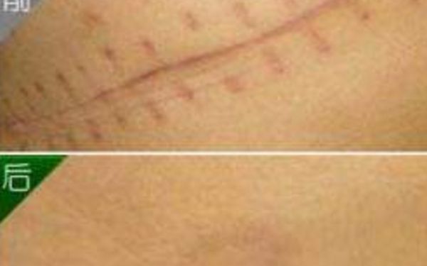 北京非常受歡迎的鼻部整形醫(yī)生，排名一覽！