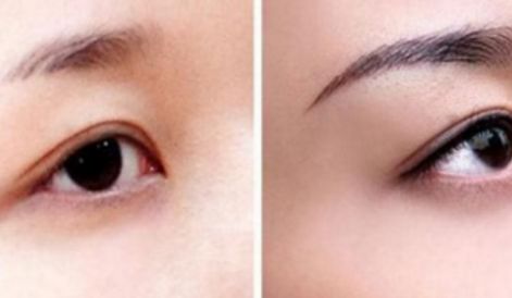 新一期海南隆鼻醫(yī)院名單來啦！維多利亞實力引領口碑榜！