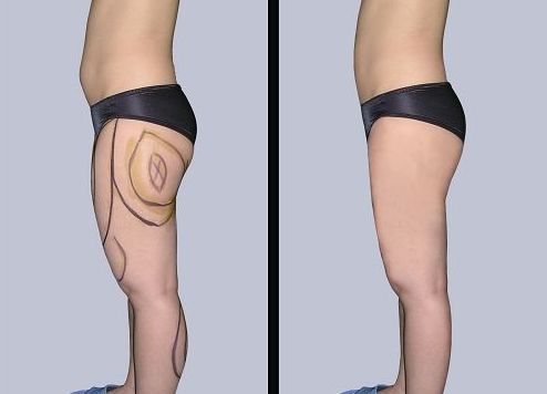 成都最佳雙眼皮修復(fù)五位大師揭曉  專家名單介紹完整