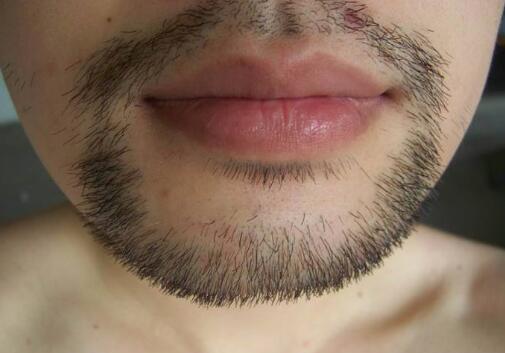 哪些醫(yī)院是滄州祛疤的好選擇？你知道嗎？