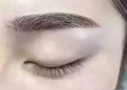 寧波美容整形醫(yī)院有哪些值得關注？這幾家醫(yī)院的口碑如何？