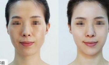 郴州市十佳整形醫(yī)院盤點，名醫(yī)推薦，千萬不要錯過！