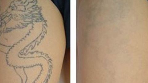 2023年鄭州整形醫(yī)院最新推薦！天后、華領(lǐng)、美萊等全面介紹！