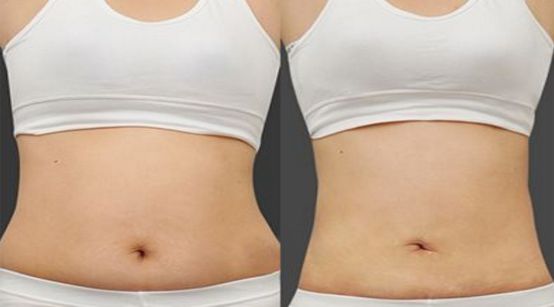 搶先掌握北京市雙眼皮醫(yī)生榜單名單，詳細了解醫(yī)生資料