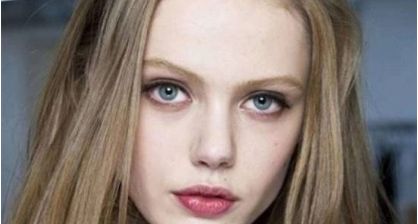 北京著名整形專家王光輝展示雙眼皮術的絕美案例，讓您了解如何變美的方法