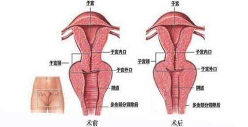上海九院哪里能夠得到專業(yè)的隆鼻手術(shù)？排行榜最新推薦五位頂尖隆鼻專家