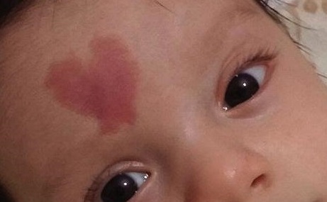 深圳天愛整形醫(yī)院好不好？技術(shù)牛不牛？醫(yī)生口碑怎么樣？擅長的項目價格如何公布？