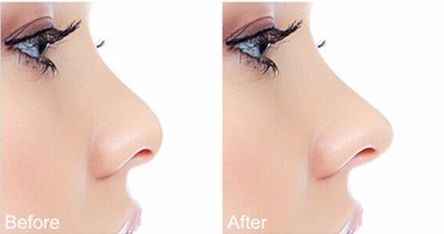 廣西愛思特劉曉軍耳再生費用、技術(shù)詳解！優(yōu)勢特點一覽！