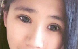 羅飛彪醫(yī)生開展的鼻子整形手術(shù)，售價(jià)一覽表，各種風(fēng)格任你挑選！