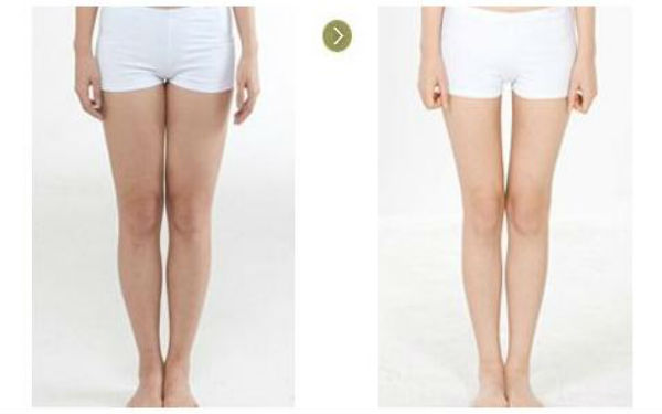 杭州哪家醫(yī)院的激光提升面部效果比較好？2023年排名前10名醫(yī)療美容醫(yī)院綜合評(píng)測(cè)！