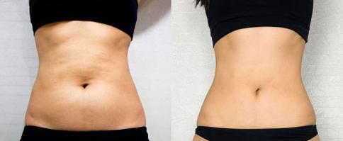 重慶五洲婦兒醫(yī)院整形科口碑好不好？醫(yī)生技術(shù)如何？在線預(yù)約咨詢！