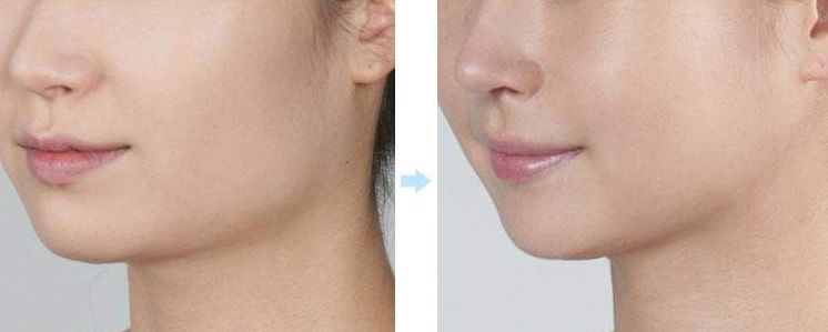 成都整形醫(yī)院揭曉：這五家醫(yī)院獲得排名前列！