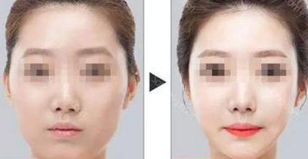 石家莊最受歡迎的除皺美容醫(yī)院排名榜前六來襲！2023年超贊抗衰除皺全攻略！