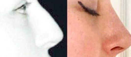 杭州整容醫(yī)生：陳小平、曾海峰長期位居榜首