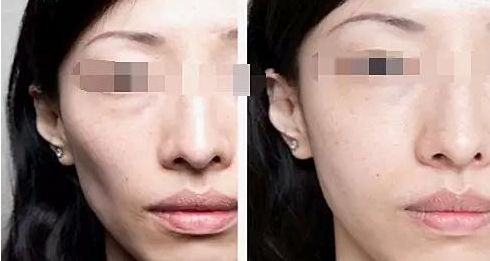 廈門整容醫(yī)院實力排名揭曉，輕松擁有美麗容顏！