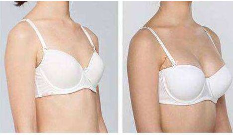 杭州美萊高士乾醫(yī)生的優(yōu)秀技能展示及下頜整形手術成功案例分享