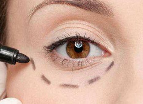 唐山優(yōu)秀雙眼皮修復(fù)醫(yī)生口碑盤點(diǎn)，案例分析、價(jià)格透明