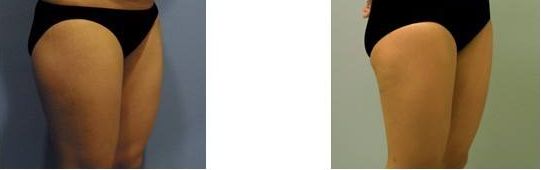 沈陽雙眼皮整形醫(yī)生哪位技術出眾？受歡迎的三位醫(yī)師推薦2023