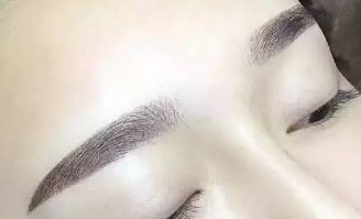 杜園園2023年雙眼皮修復(fù)案例揭秘，浦東區(qū)獨(dú)家經(jīng)驗(yàn)分享