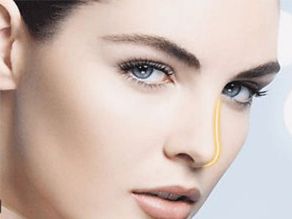 煙臺曹品根醫(yī)生的雙眼皮修復(fù)經(jīng)驗(yàn)揭秘，90天修復(fù)案例全記錄