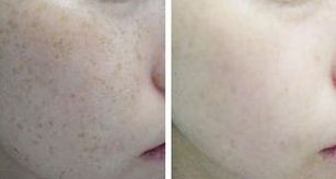 2023上海整容醫(yī)生榜單揭曉：韋敏、柴崗、林曉曦等榮登榜首