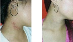 全國(guó)各大醫(yī)院推薦！拉皮手術(shù)高水平醫(yī)院盤(pán)點(diǎn)