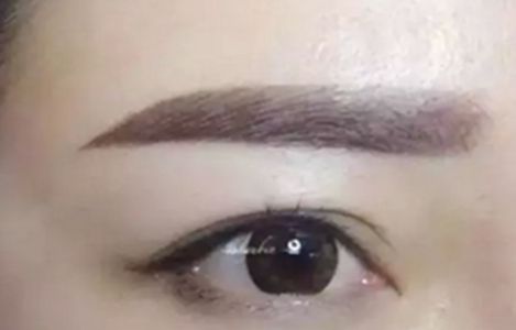 南昌美伊爾醫(yī)院的劉立軍醫(yī)生手術(shù)實力如何？擅長哪些手術(shù)？附真實案例為參考