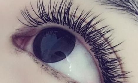 昆明專家解讀雙眼皮眼部整形，技術(shù)獨(dú)步巍峨