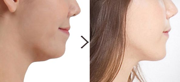 整形美容院選擇指南：華美、珍潤(rùn)、藍(lán)山等品牌綜合比較，價(jià)格一覽表！