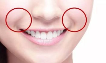 北京八大處整容院滕利醫(yī)生擅長(zhǎng)哪些項(xiàng)目？磨骨案例被公開揭秘