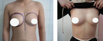 武漢優(yōu)秀鼻部專(zhuān)家排行榜公布，前五位備受矚目