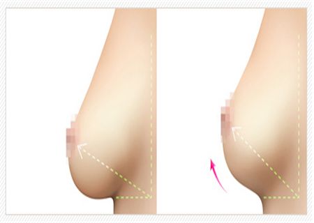 重慶銅雀臺區(qū)內(nèi)雙眼皮醫(yī)生技術評析，黃世輝、趙唱熙、朱本谷登峰造極