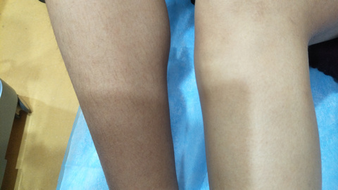 湘西自治州人民醫(yī)院燒傷美容整形科是否能滿足療效和口碑的雙重期望？有哪些備受推崇的醫(yī)生值得推薦？