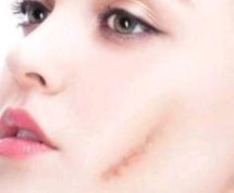 北京雙眼皮技術(shù)出色的醫(yī)院榜單，手術(shù)滿意度高贊醫(yī)院共享