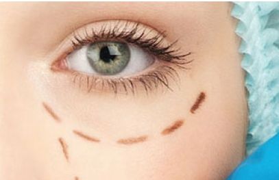 2023年首都北京近視手術(shù)醫(yī)生排行曝光！全面評估：口碑價(jià)位詳解，助你找到最佳矯正方案！