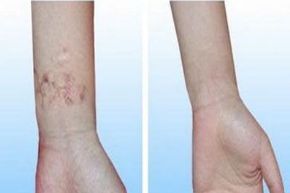 廣州地區(qū)口碑良好的植發(fā)醫(yī)院有哪些？就醫(yī)者推崇的醫(yī)院排名揭秘