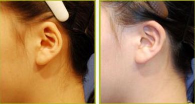 沈陽整形行業(yè)的隆鼻醫(yī)生排名Top10  網(wǎng)友推薦集結(jié)