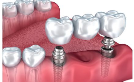 廣州華美高順福鼻修復(fù)帶來(lái)的革命性體驗(yàn)案例揭秘