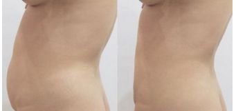 全國鼻子整形醫(yī)院排名揭曉，這幾家醫(yī)院上榜！